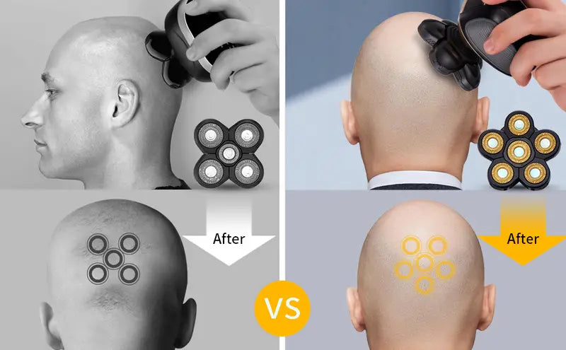 5-in-1 Cordless Bald Head Shaver Grooming Kit